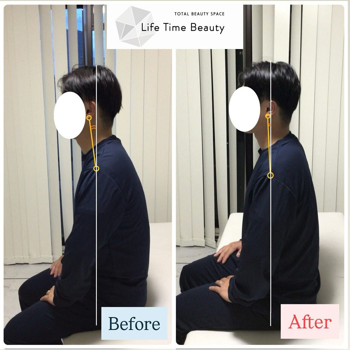 【Before → After✨】