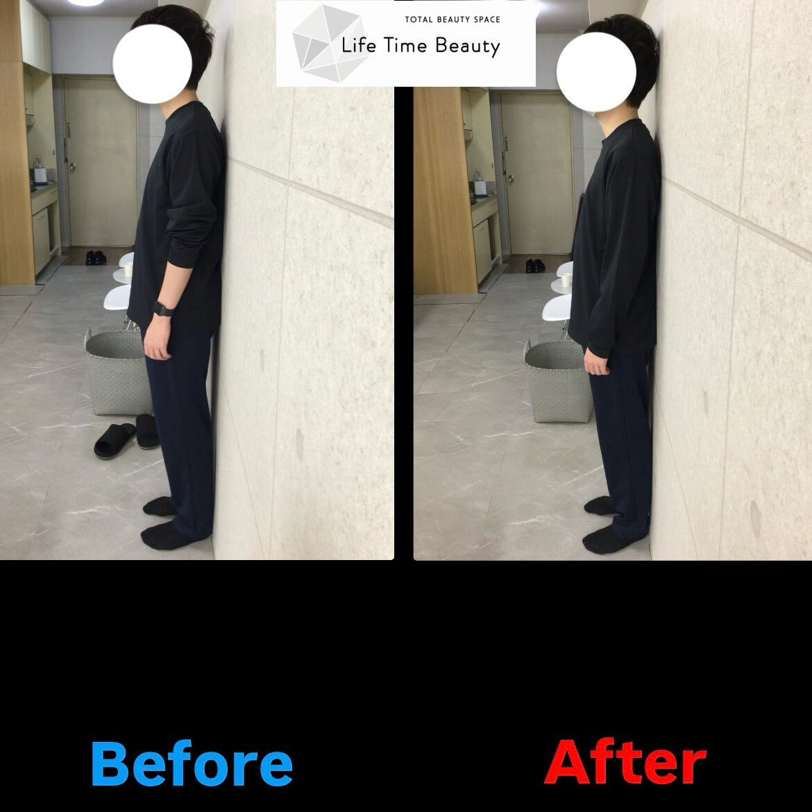 【Before→After✨】