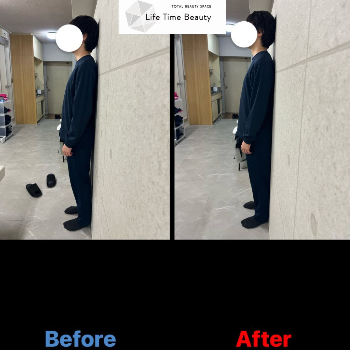 【Before→After✨】 