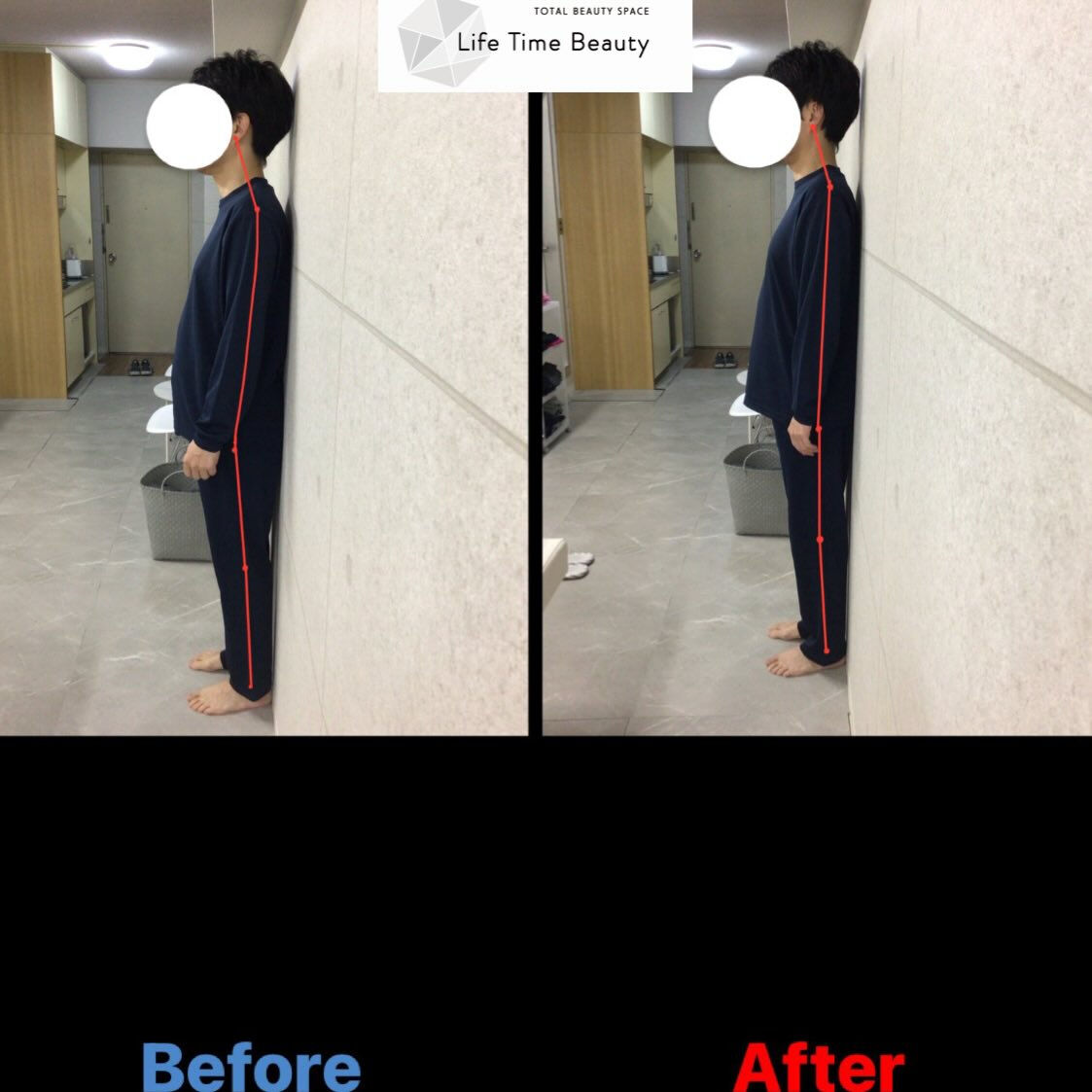 【Before→After✨】　